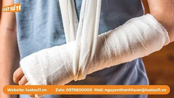 Giám định tỷ lệ tổn thương cơ thể là căn cứ xem xét trách nhiệm hình sự